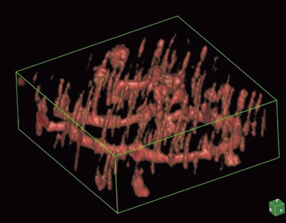 図11　セクショントポグラフを10 μm間隔で撮影し、得られた画像を処理した4H SiC ウェーハにおける転位の3次元像。